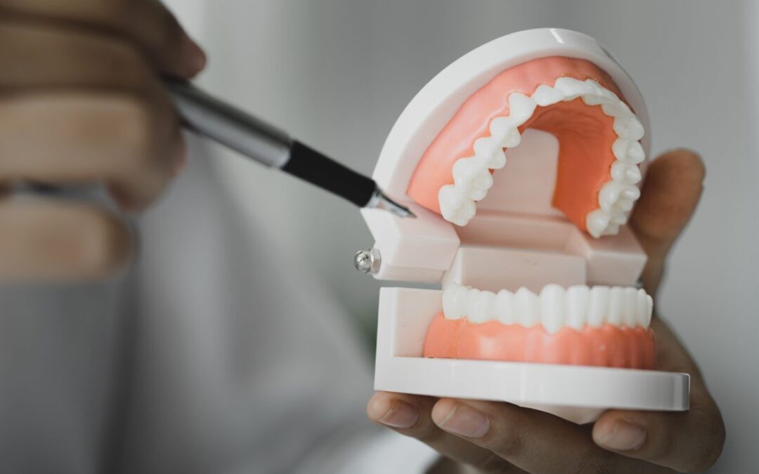 Veneers, Crowns & Dentures