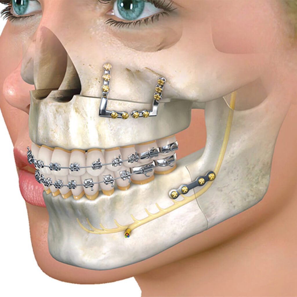 Maxillofacial Surgery